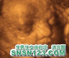 怀孕250天宝宝发育图