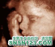 怀孕264天宝宝发育图