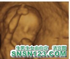怀孕96天宝宝发育图