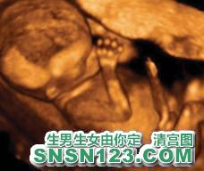 怀孕103天宝宝发育图