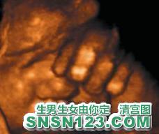 怀孕276天宝宝发育图