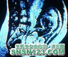 怀孕243天宝宝发育图
