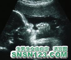 怀孕242天宝宝发育图