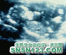 怀孕144天宝宝发育图