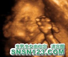 怀孕178天宝宝发育图