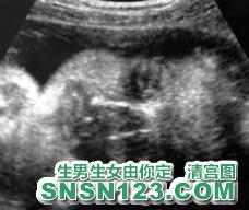 怀孕221天宝宝发育图