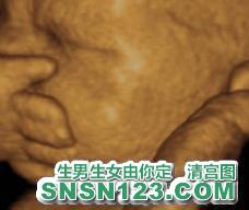 怀孕266天宝宝发育图
