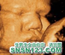 怀孕274天宝宝发育图