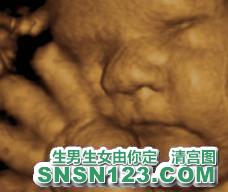 怀孕270天宝宝发育图