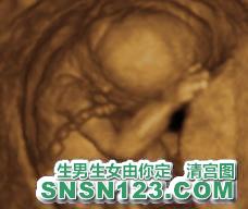 怀孕115天宝宝发育图