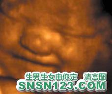 怀孕253天宝宝发育图
