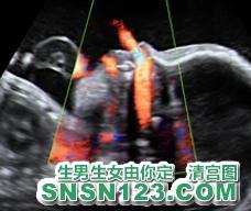 怀孕184天宝宝发育图