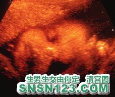怀孕279天宝宝发育图