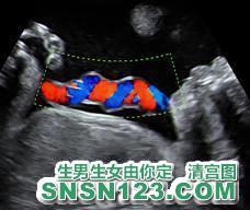 怀孕224天宝宝发育图
