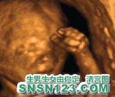 怀孕124天宝宝发育图