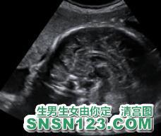 怀孕146天宝宝发育图