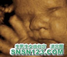 怀孕273天宝宝发育图