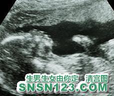 怀孕158天宝宝发育图
