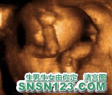 怀孕128天宝宝发育图