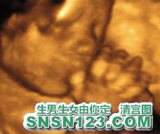 怀孕172天宝宝发育图