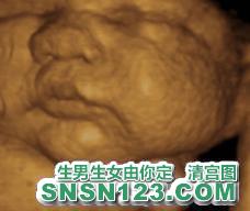 怀孕269天宝宝发育图