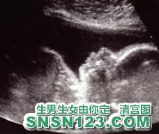 怀孕176天宝宝发育图