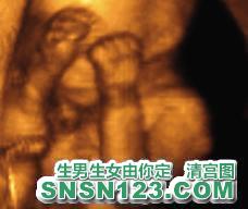 怀孕139天宝宝发育图