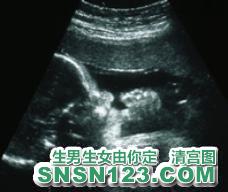 怀孕239天宝宝发育图