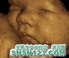 怀孕268天宝宝发育图