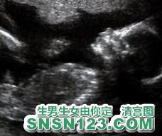 怀孕168天宝宝发育图