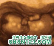 怀孕117天宝宝发育图