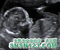 怀孕116天宝宝发育图