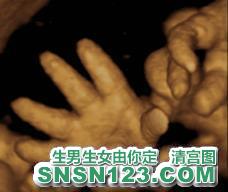怀孕278天宝宝发育图